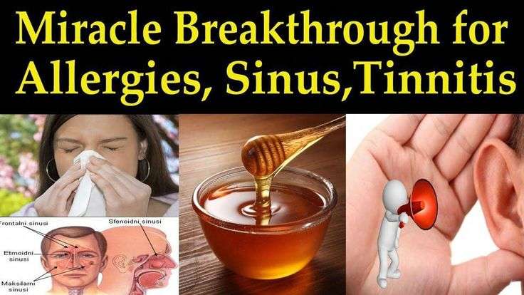 Miracle Breakthrough for Allergies, Sinusitis, &  Tinnitus ...