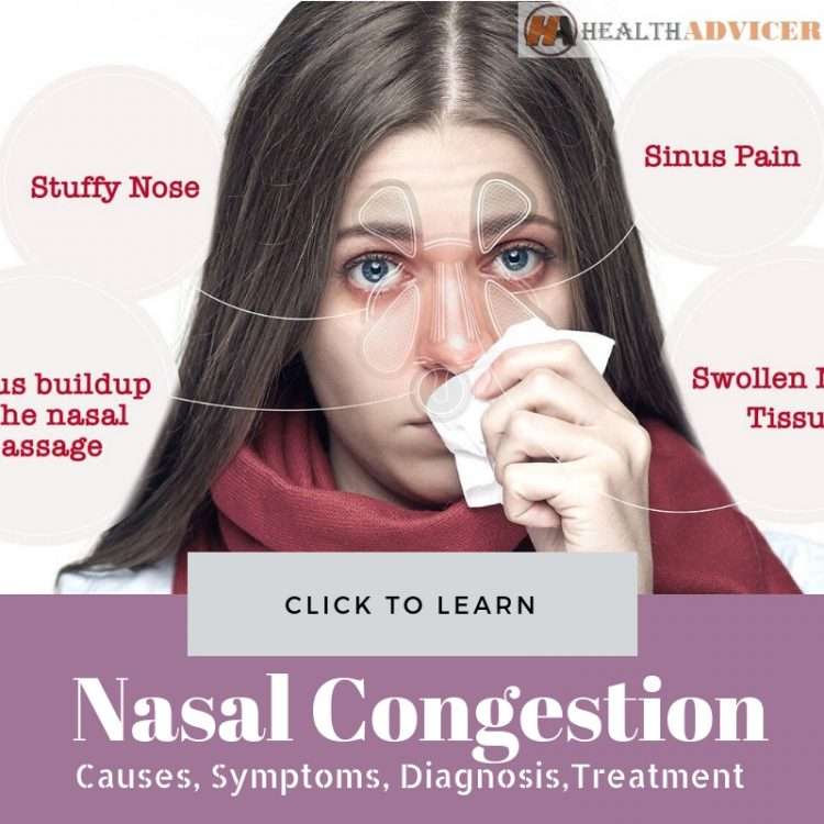 Nasal Congestion: Causes, Picture, Symptoms, and Treatment