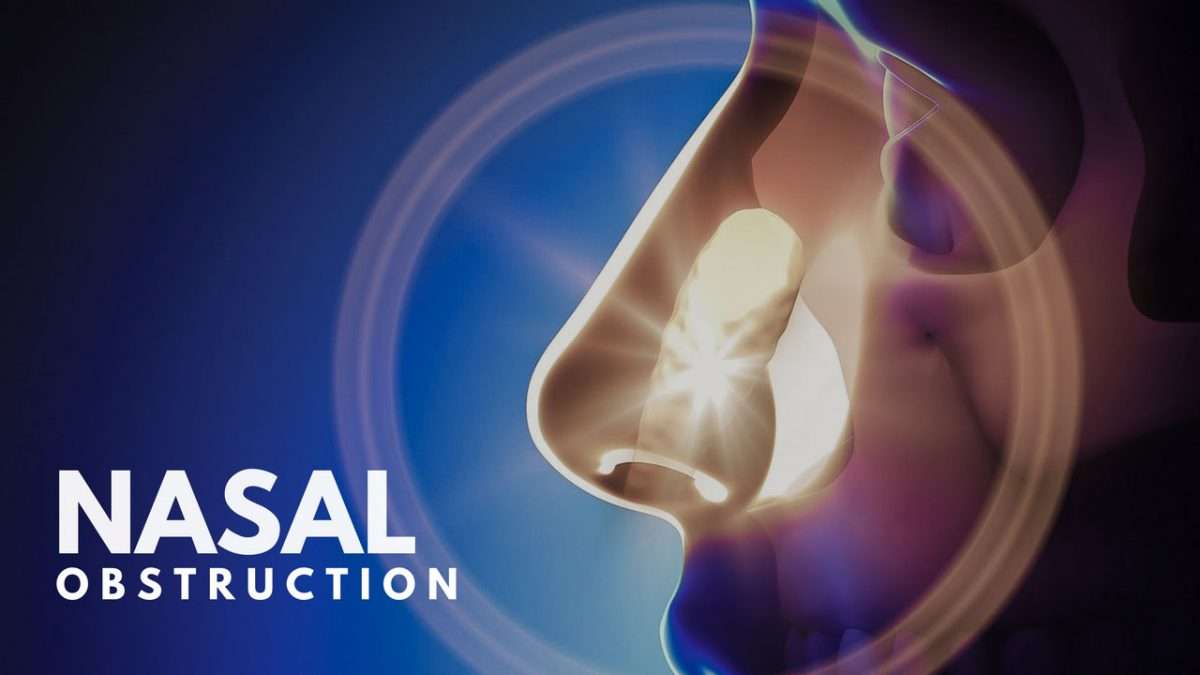 Nasal Obstruction &  Sleep Apnea Video From Capital Otolaryngology