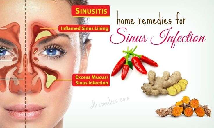 Natural home remedies for sinus infection in adults show ...