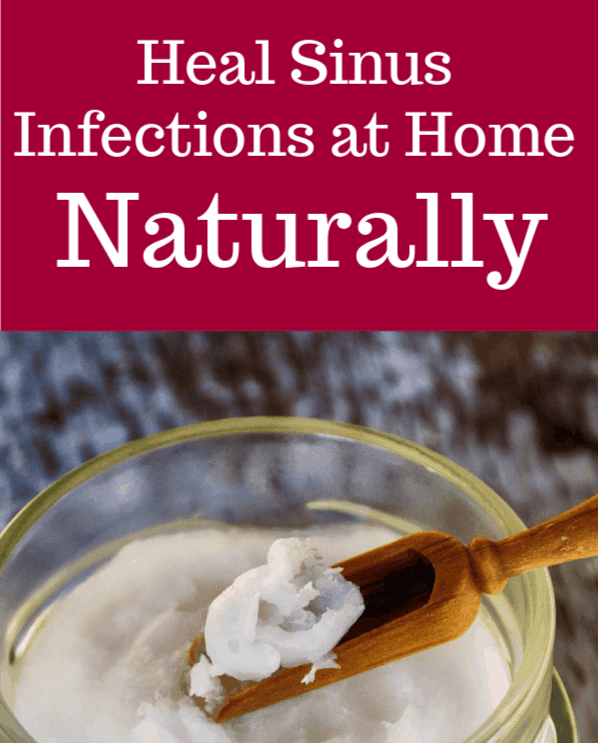 Natural Home Remedies for Sinus Infections