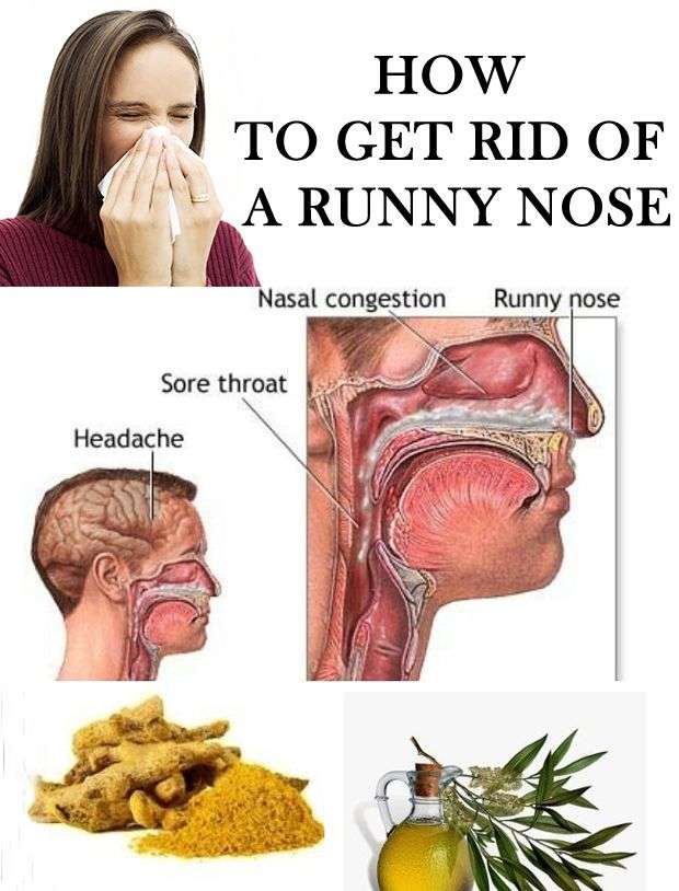 Natural Remedies to Get Rid of Runny Nose