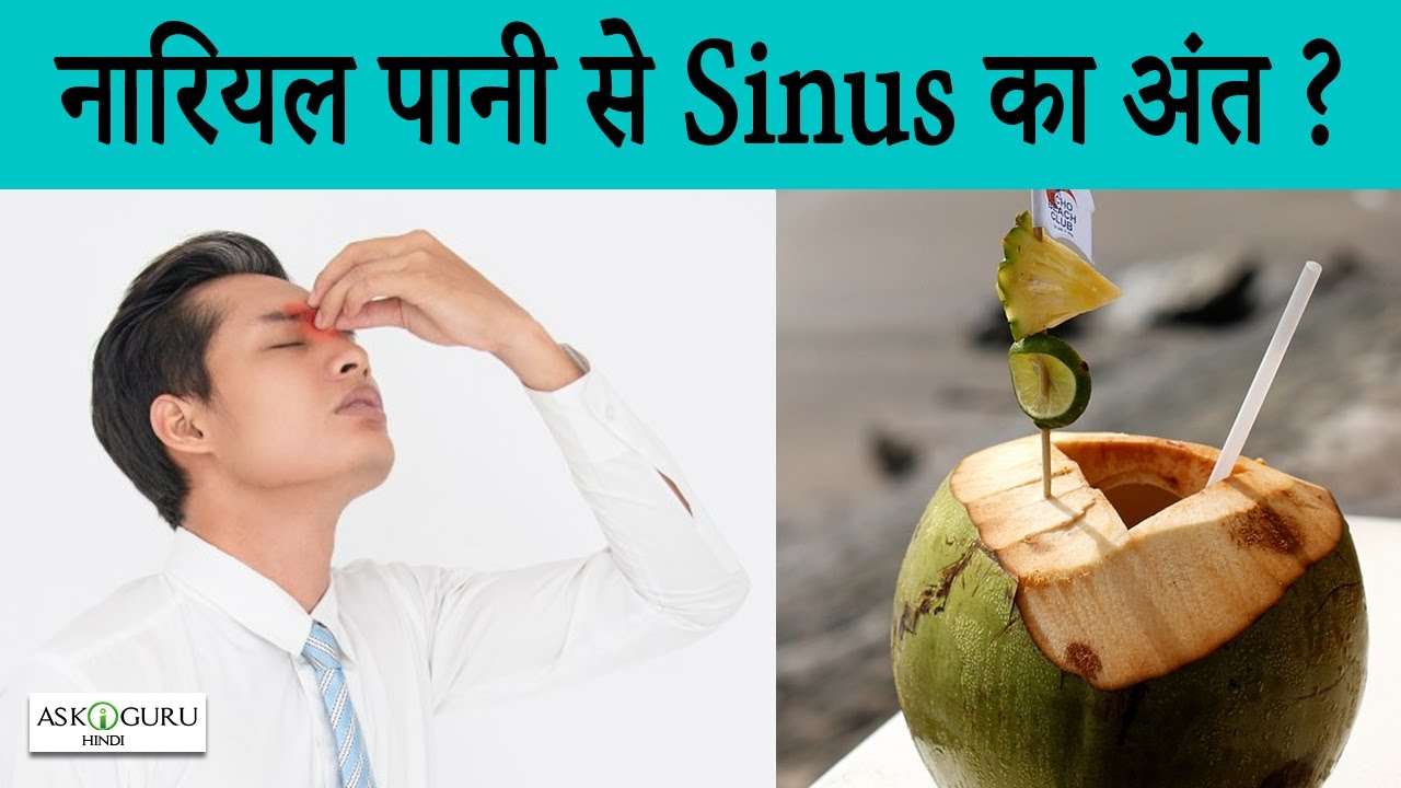 NATURAL REMEDY FOR SINUS
