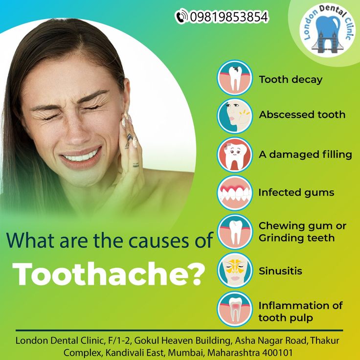 Pin on Toothache