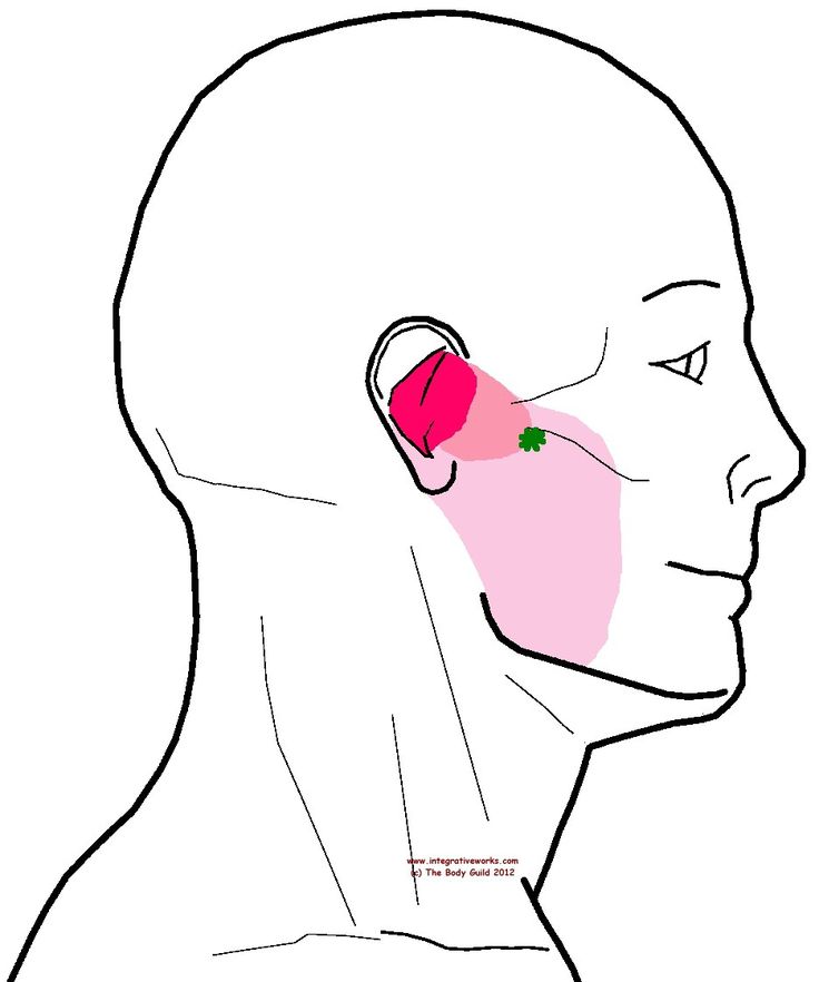 Pin on Trigger points
