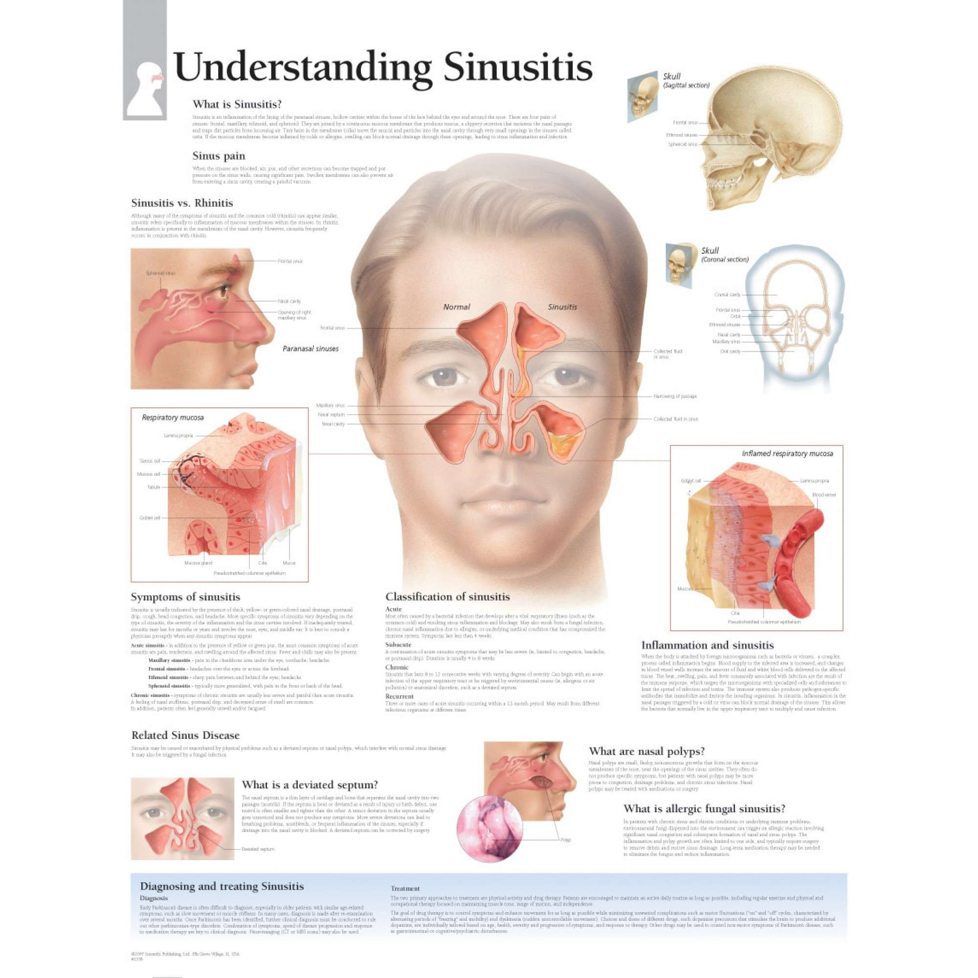 Quotes about Sinuses (32 quotes)