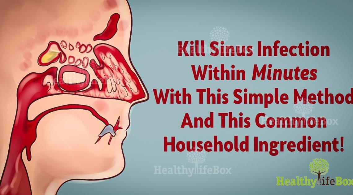 Remove Sinus Infection Within Minutes With A Kitchen Ingredient  Gif Club