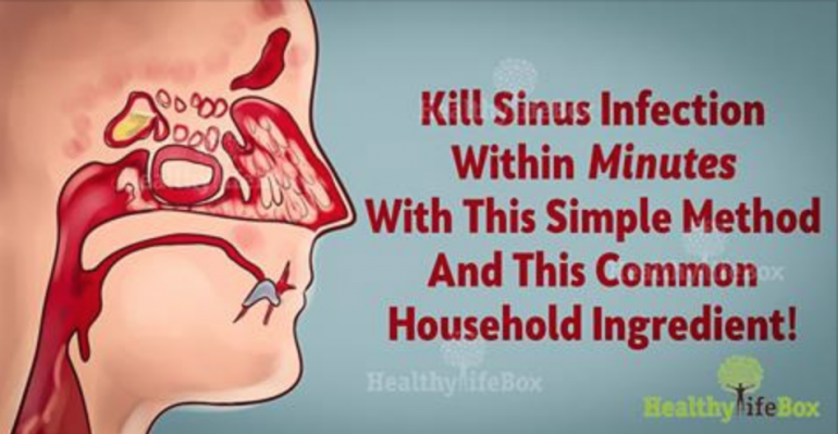 Remove Sinus Infection Within Minutes With A Kitchen ...