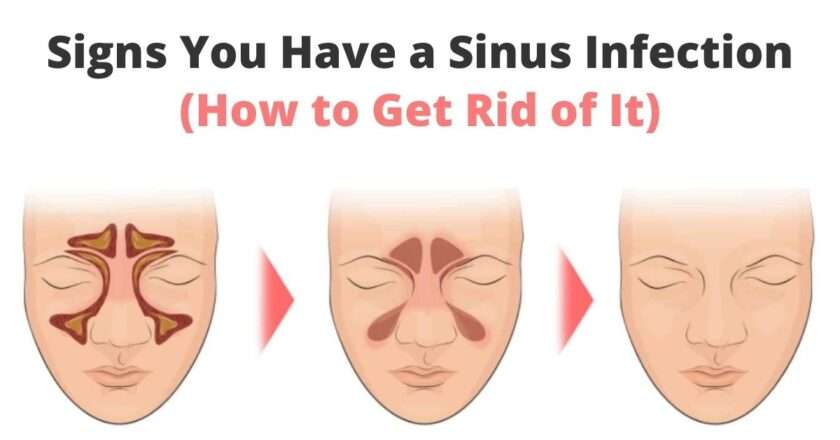 Signs You Have a Sinus Infection (How to Get Rid of It)