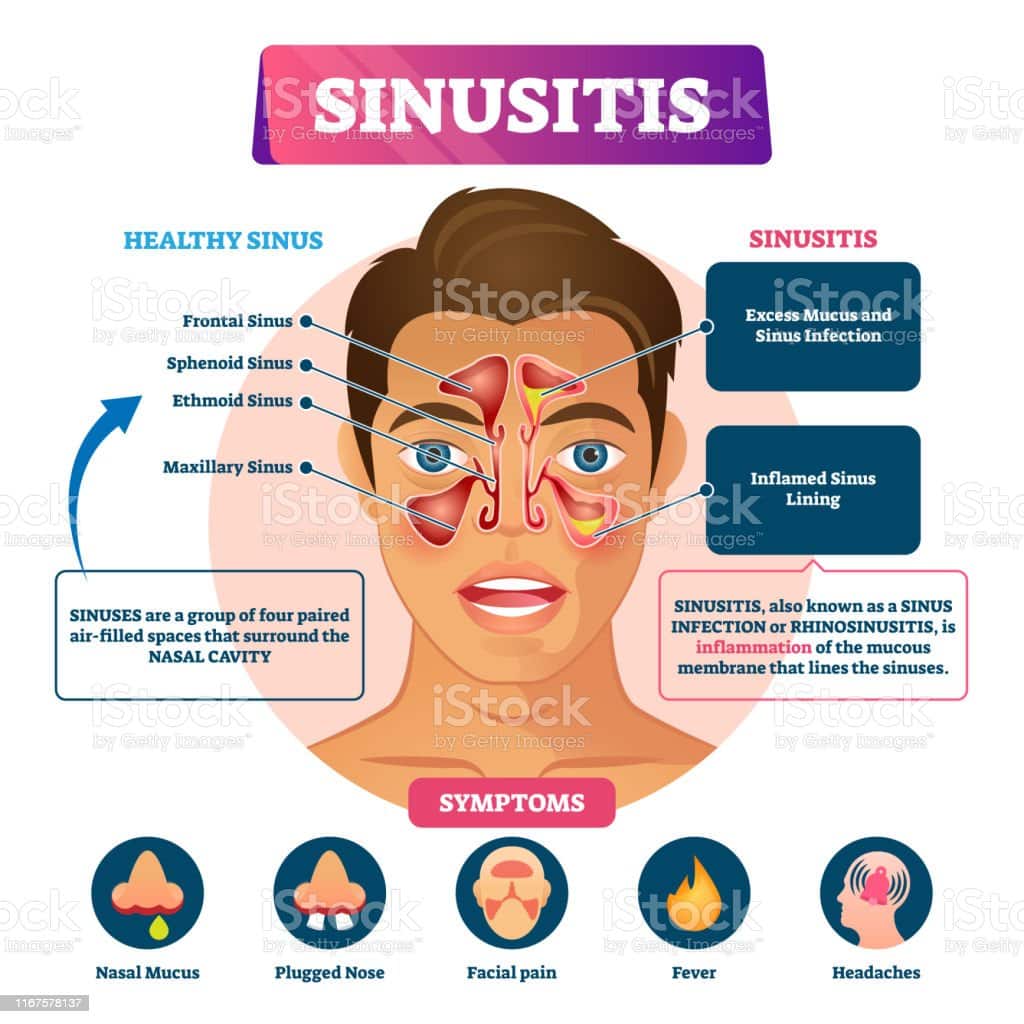 Sinus Contamination Symptoms Discharge From Eyes
