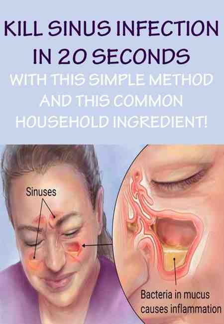 Sinus Drainage Sore Throat Remedy Ear Sleepy Make ...