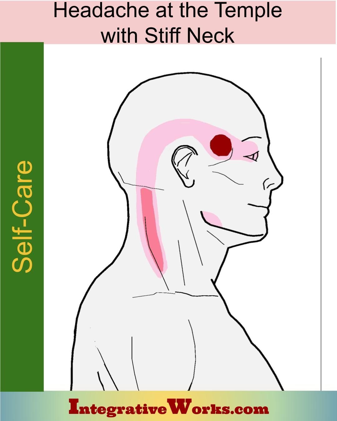 Sinus Headache Neck Shoulder Pain