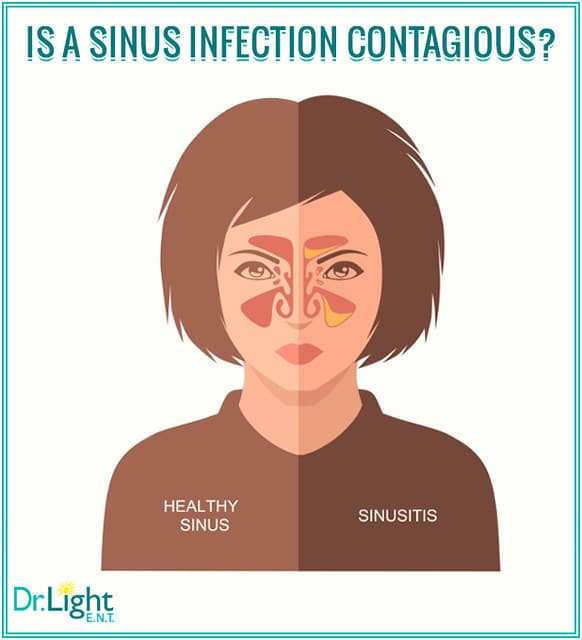 Sinus Infection Contagious? Yes and No. Read Why