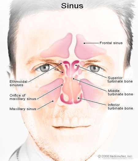 Sinus Infection (Sinusitis) Symptoms, Signs, Treatment &  Remedies
