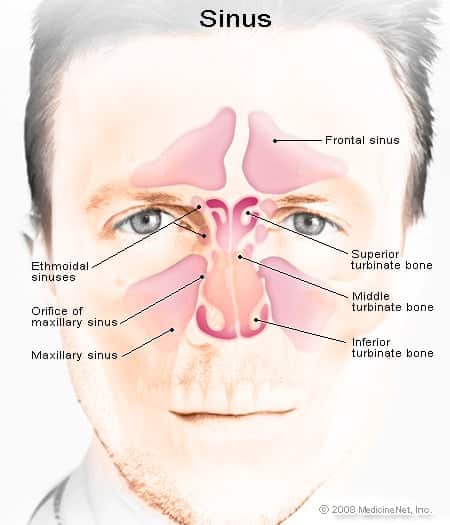 Sinus Infection (Sinusitis): Symptoms, Treatment, Contagious &  Home ...