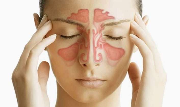 Sinus Infection vs Common Cold