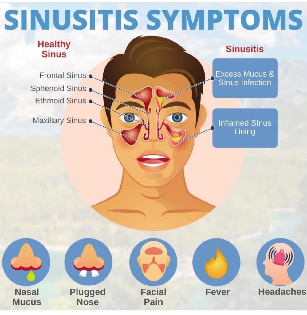 Sinus Issues