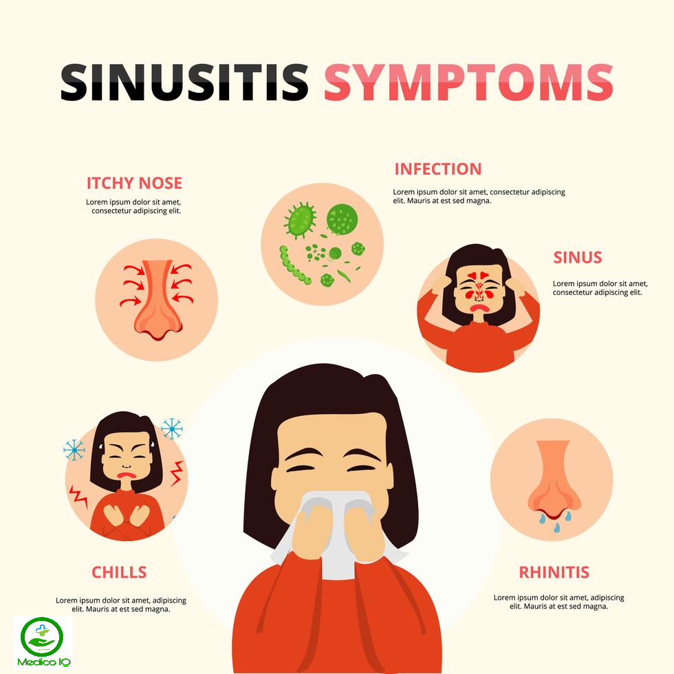 Sinusitis Causes, Symptoms &  Treatment ( Sinus Infection )