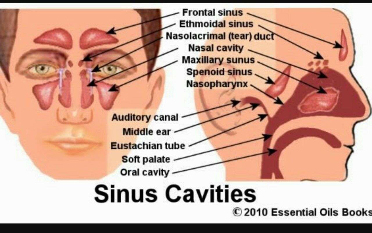 Sinusitis Infection Is It Contagious Severe Tinnitus Depression