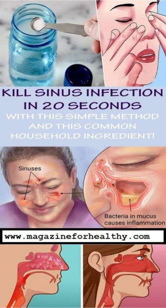 Struggling with Sinus Infection? Heres how to quickly get rid of it ...