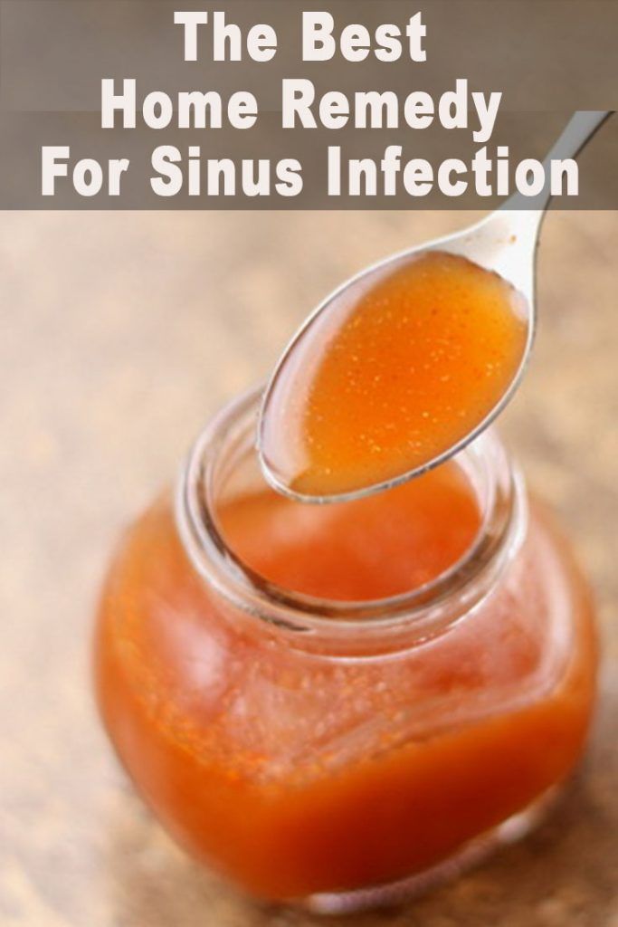 The Best Home Remedy For Sinus Infection Sinus inflammation accompanied ...