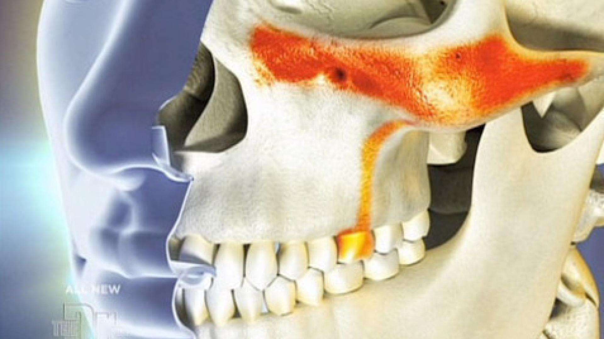 Toothache Sinus Symptoms