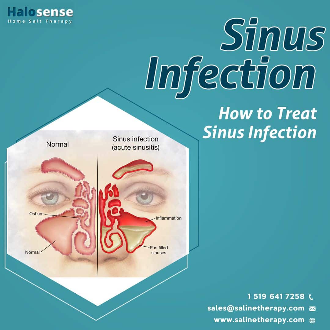 Top Foods For Sinus Infection