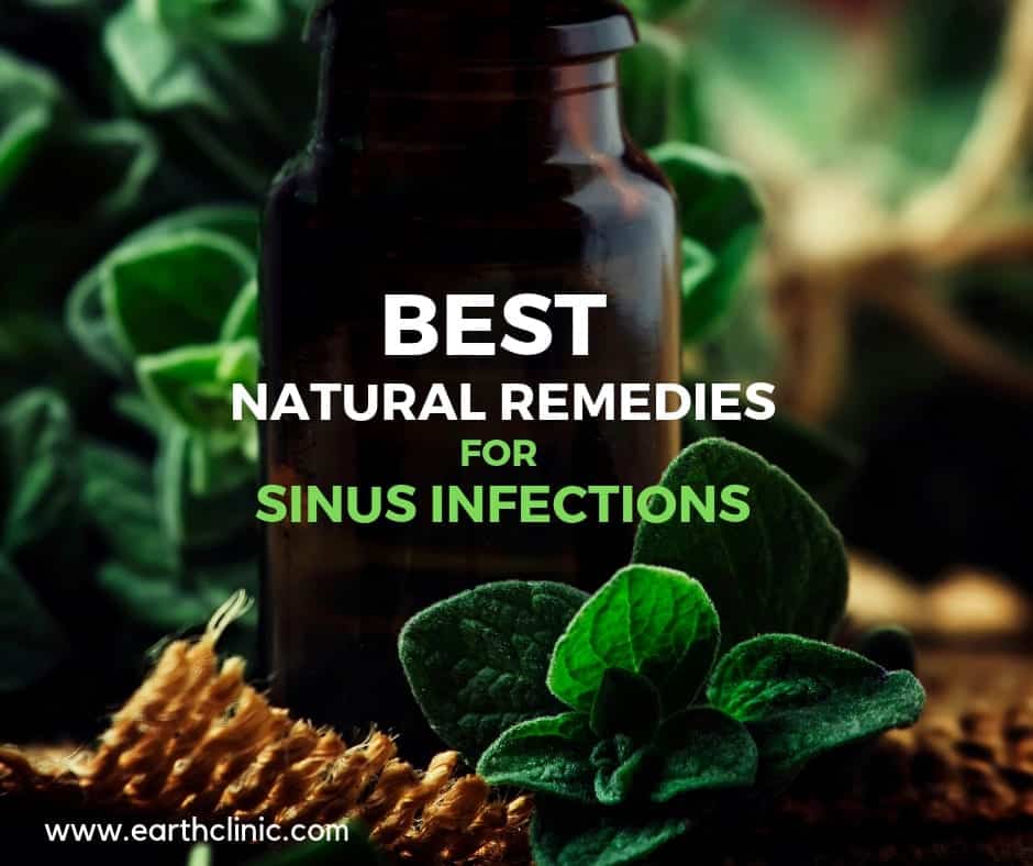 Top Natural Remedies for Sinus Infections