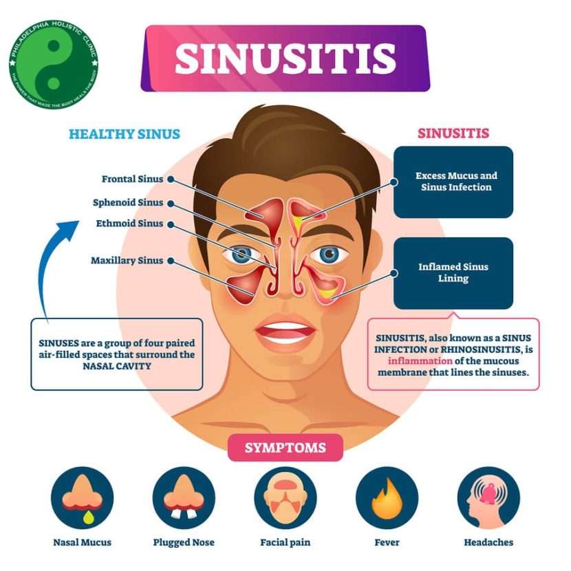 treatment for sinus infection