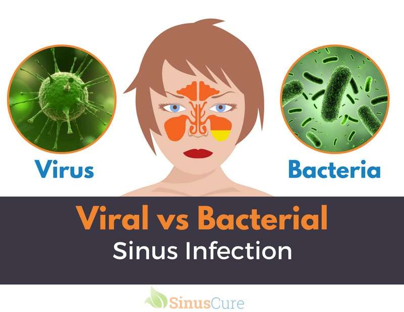 Viral or Bacterial Sinus Infection? What the Difference?