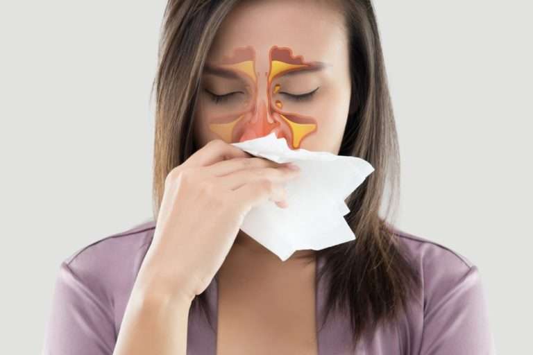 What Foods to Avoid if You Have Sinusitis?