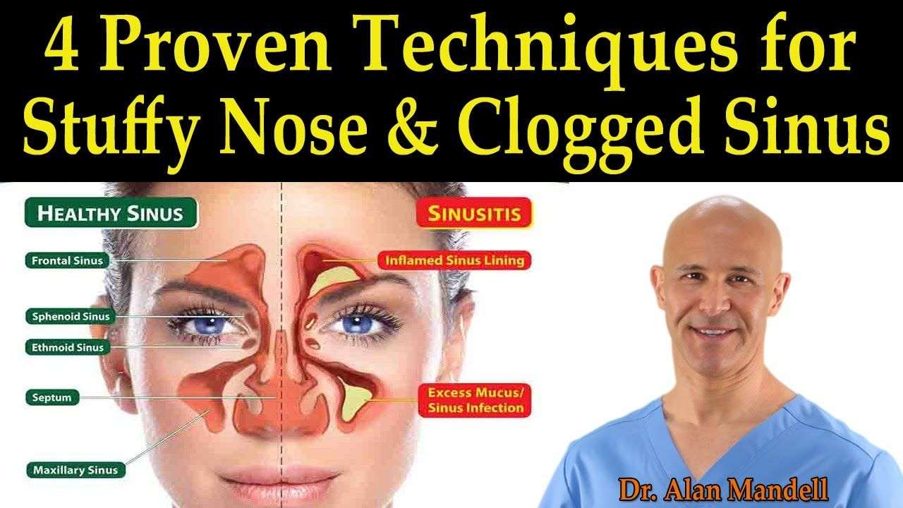 What Helps Jaw Pain From Sinus Infection