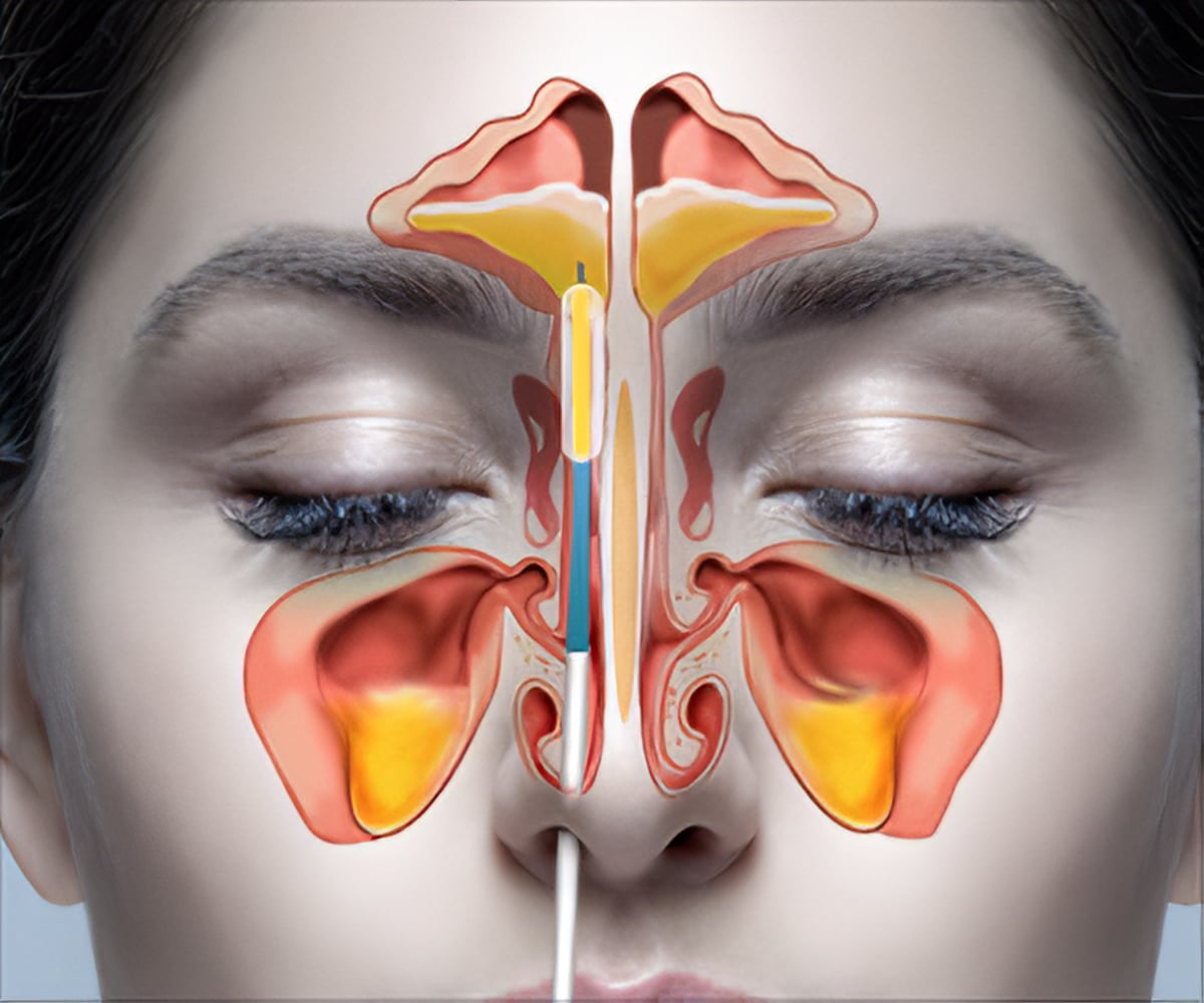 What you need to know before you have your Nose or Sinus Surgery job ...